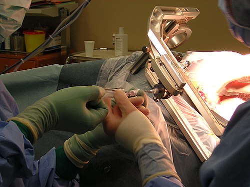 Stereotactic surgery